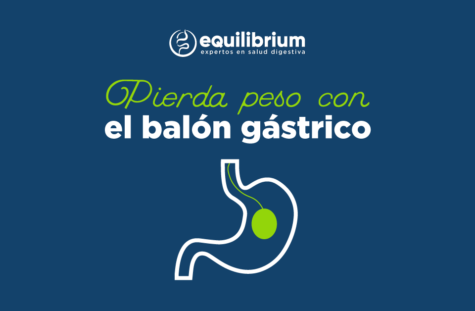 Pierda peso con el balón intragástrico